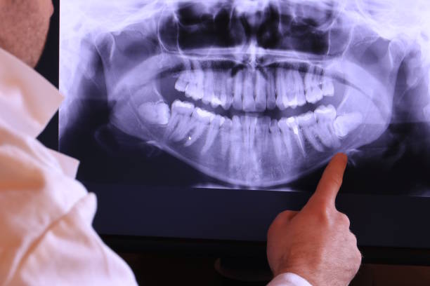 Best Walk-In Emergency Dental Services in Oildale, CA