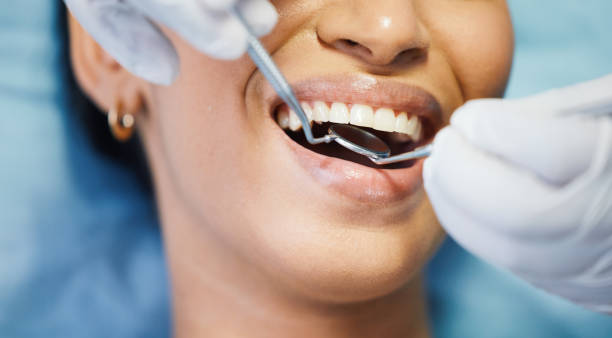 Best Emergency Cosmetic Dentistry (e.g., broken veneers) in Oildale, CA